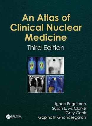 Ignac Fogelman, Susan Clarke, Gary Cook, Gopinath Gnanasegaran - Atlas of Clinical Nuclear Medicine, E-bok