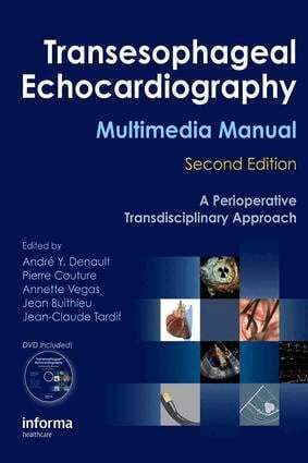 André Denault, Pierre Couture, Annette Vegas, Jean Buithieu, Jean-Claude Tardif - Transesophageal Echocardiography Multimedia Manual, E-bok