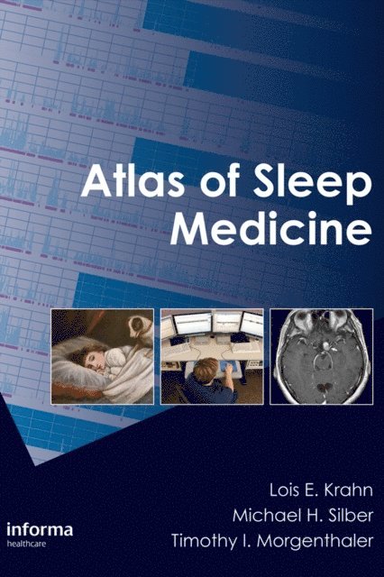 Timothy I. Morgenthaler, Michael H. Silber, Lois E. Krahn - Atlas of Sleep Medicine, E-bok. Tillgänglighet: Lägg i varukorg