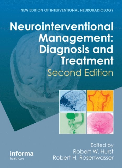 Robert H. Rosenwasser, Robert W. Hurst - Neurointerventional Management, E-bok