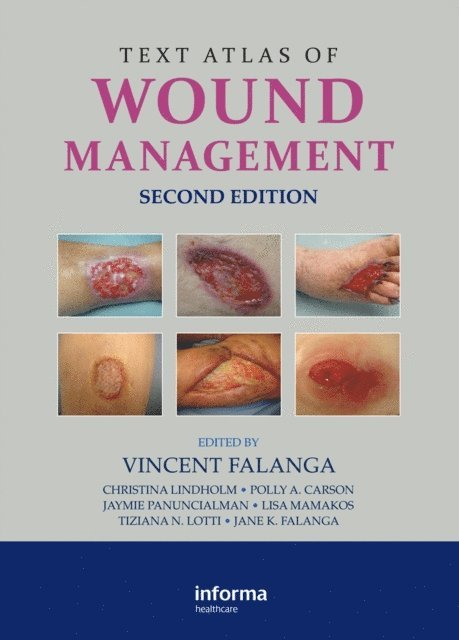 Jane K. Falanga, Lotti N. Tiziana, Lisa Mamakos, Jaymie Panuncialman, Polly A. Carson, Christina Lindholm, Vincent Falanga - Text Atlas of Wound Management, E-bok
