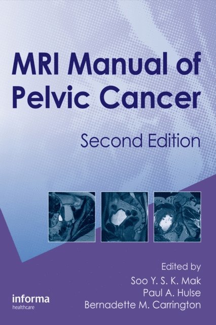 B M Carrington, Paul A. Hulse, Soo Mak - MRI Manual of Pelvic Cancer, E-bok