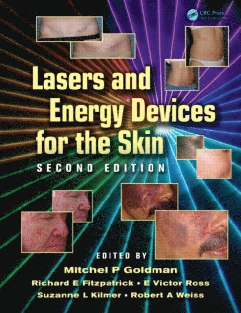 Robert A. Weiss, Suzanne L. Kilmer, E. Victor Ross, Richard E. Fitzpatrick, Mitchel P. Goldman - Lasers and Energy Devices for the Skin, E-bok