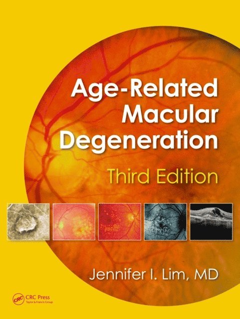 Jennifer I. Lim - Age-Related Macular Degeneration, Third Edition, E-bok