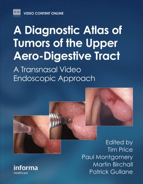 Patrick Gullane, Martin Birchall, Paul Montgomery, Tim Price - Diagnostic Atlas of Tumors of the Upper Aero-Digestive Tract, E-bok