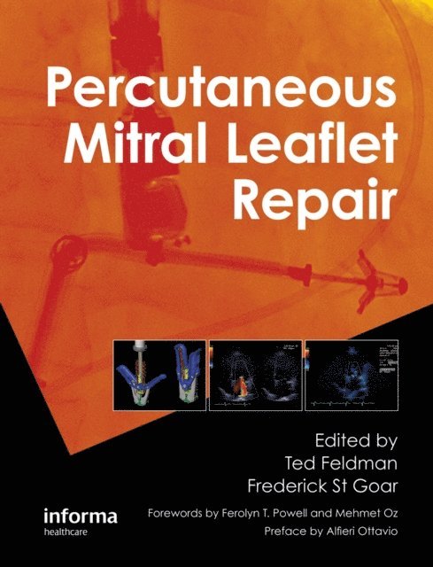 Frederick St Goar, Ted Feldman - Percutaneous Mitral Leaflet Repair, E-bok