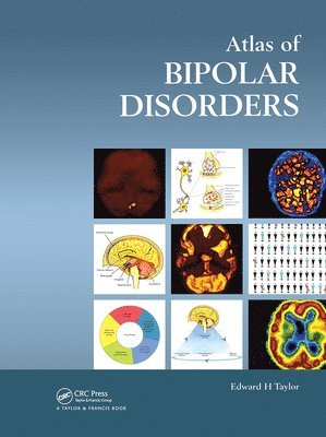 Edward H. Taylor - Atlas of Bipolar Disorders, Inbunden