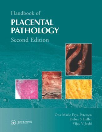 Ona Marie Faye-Petersen, Debra S. Heller, Vijay V. Joshi - Handbook of Placental Pathology, Inbunden
