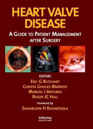 Eric G. Butchart, Christa Gohllke-Barwolf, Manuel Antunes, Roger J.C. Hall - Heart Valve Disease, Inbunden