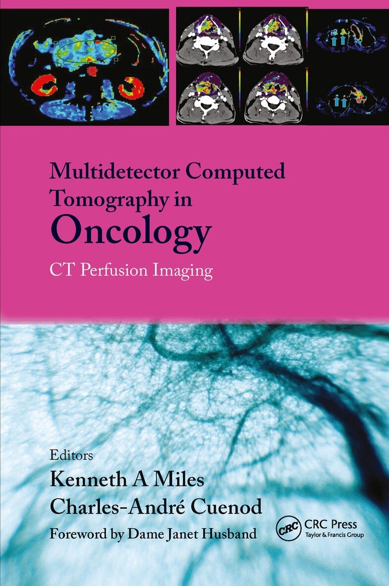 Kenneth Miles, C. Charnsangavej, C. Cuenod - Multi-Detector Computed Tomography in Oncology, Inbunden