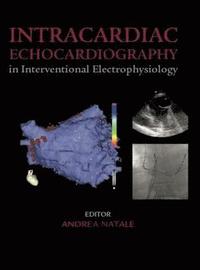 Intracardiac Echocardiography in Interventional Electrophysiology