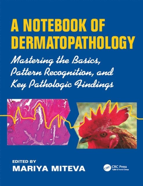 Mariya Miteva - Notebook of Dermatopathology, E-bok. Tillgänglighet: Lägg i varukorg