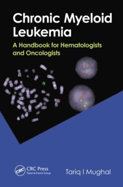 Tariq I. Mughal - Chronic Myeloid Leukemia, E-bok