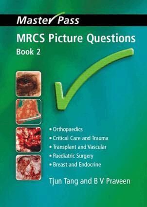 Tjun Tang, BV Praveen - MRCS Picture Questions, Häftad. Tillgänglighet: Lägg i varukorg