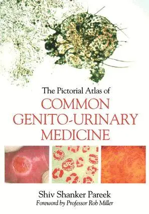 Shiva Pareek - Pictorial Atlas of Common Genito-Urinary Medicine, Häftad. Tillgänglighet: Lägg i varukorg