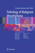 Pathology of Malignant Mesothelioma