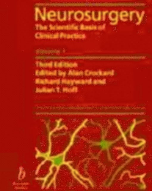 David W. Newell, Anne J. Moore - Neurosurgery, E-bok