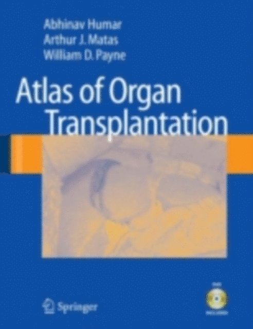William D. Payne, Arthur J. Matas, Abhinav Humar - Atlas of Organ Transplantation, E-bok. Tillgänglighet: Lägg i varukorg