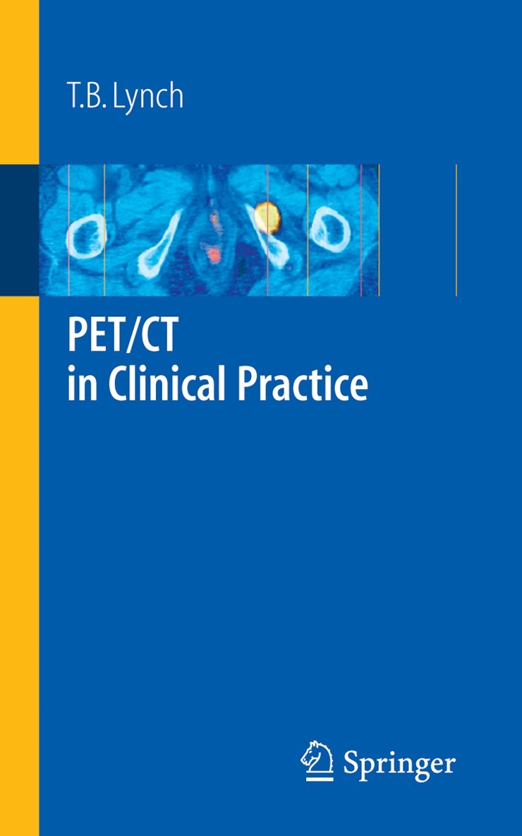 T. B. Lynch - PET/CT in Clinical Practice, Häftad. Tillgänglighet: Lägg i varukorg