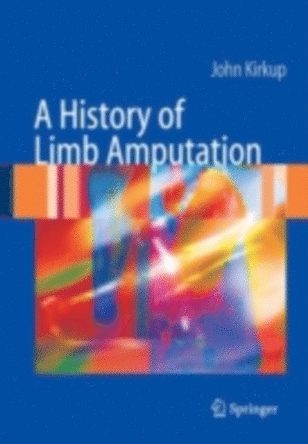 John R. Kirkup - History of Limb Amputation, E-bok