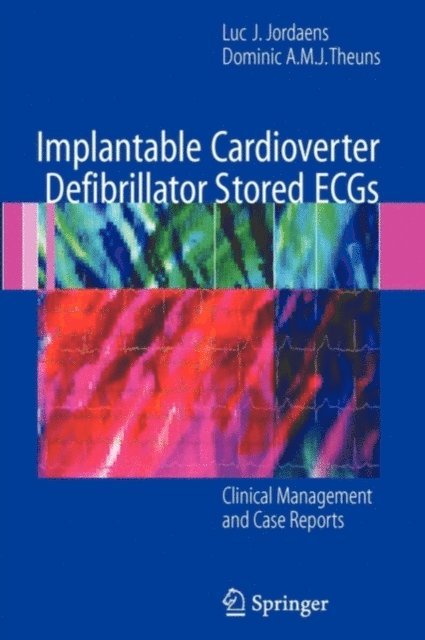 Dominic A.M.J. Theuns, Luc J. Jordaens - Implantable Cardioverter Defibrillator Stored ECGs, E-bok
