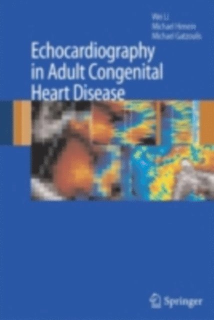 Michael A. Gatzoulis, Michael Henein, Wei Li - Echocardiography in Adult Congenital Heart Disease, E-bok