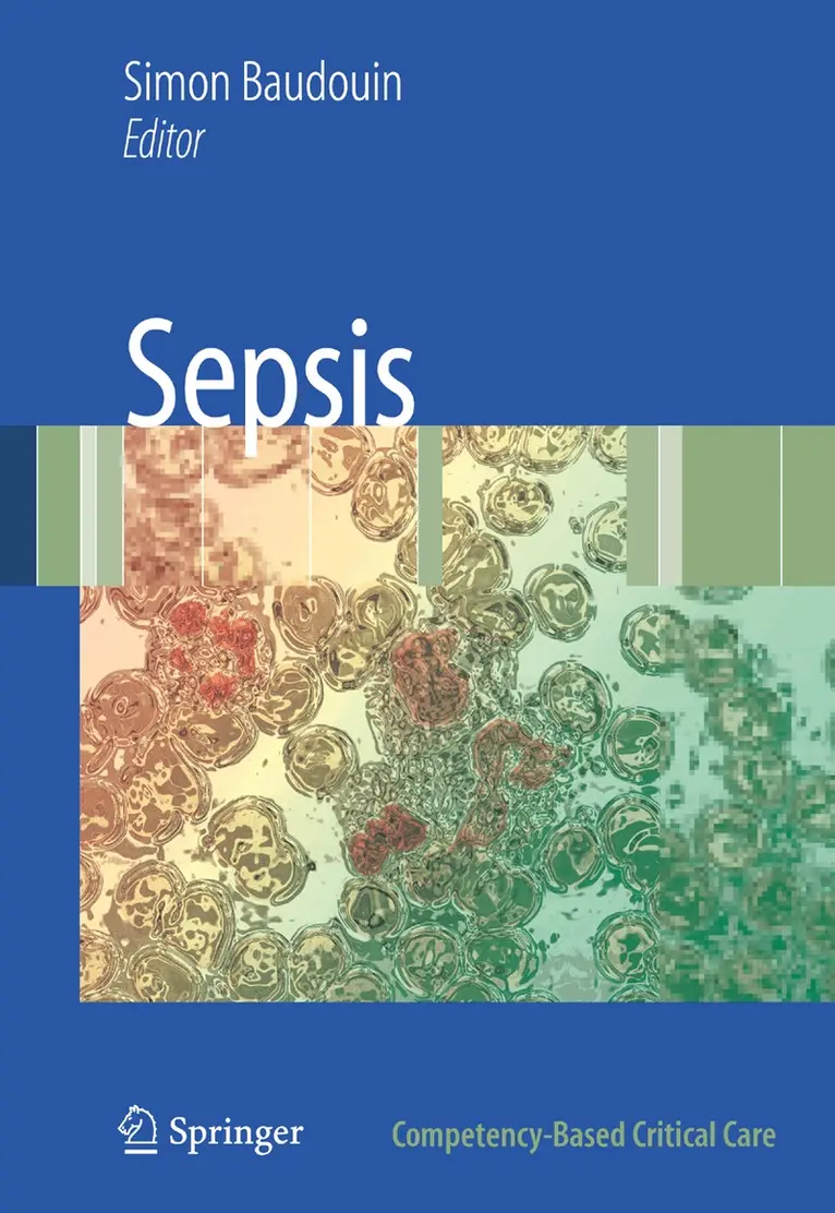 Simon V. Baudouin - Sepsis, Häftad. Tillgänglighet: Lägg i varukorg