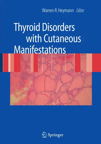 Warren R. Heymann - Thyroid Disorders with Cutaneous Manifestations, Inbunden