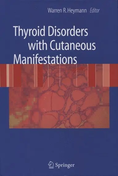 Warren R. Heymann - Thyroid Disorders with Cutaneous Manifestations, E-bok