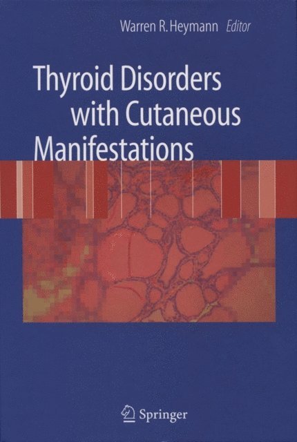 Warren R. Heymann - Thyroid Disorders with Cutaneous Manifestations, E-bok