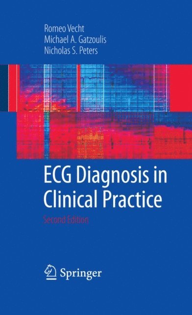 Nicholas Peters, Michael A. Gatzoulis, Romeo Vecht - ECG Diagnosis in Clinical Practice, E-bok