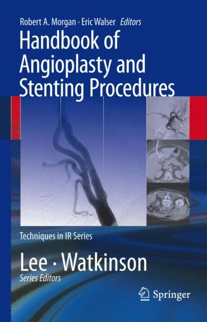 Eric Walser, Robert A. Morgan - Handbook of Angioplasty and Stenting Procedures, E-bok