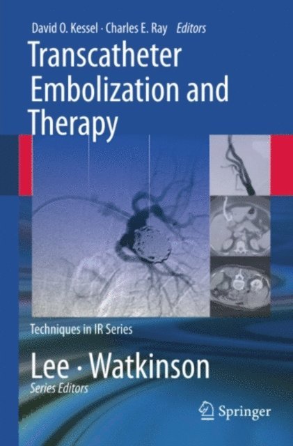 Charles Ray, David Kessel - Transcatheter Embolization and Therapy, E-bok