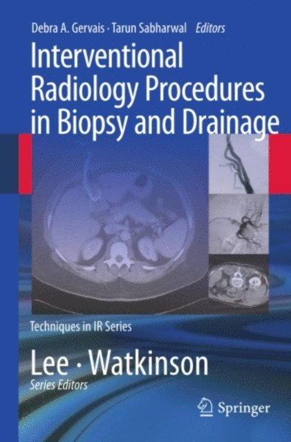 Tarun Sabharwal, Debra A. Gervais - Interventional Radiology Procedures in Biopsy and Drainage, E-bok