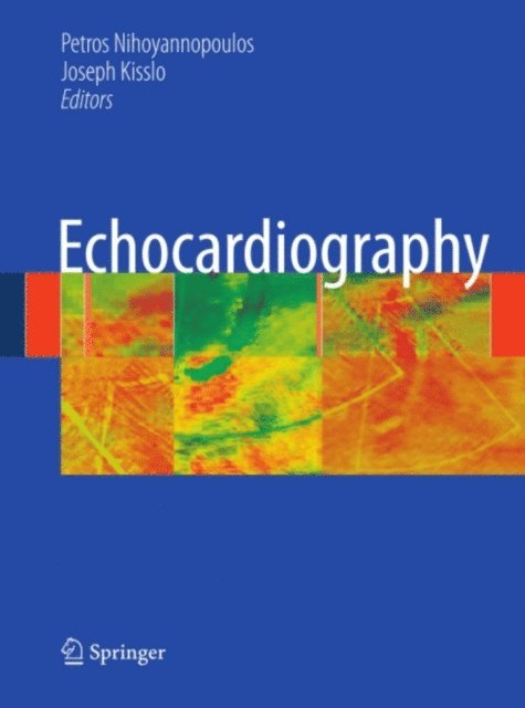 Joseph Kisslo, Petros Nihoyannopoulos - Echocardiography, E-bok