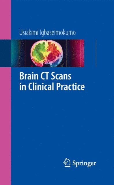 Usiakimi Igbaseimokumo - Brain CT Scans in Clinical Practice, E-bok