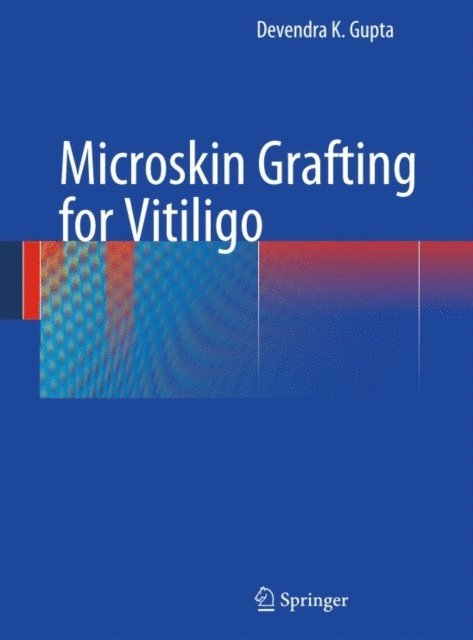 Devendra K. Gupta - Microskin Grafting for Vitiligo, E-bok