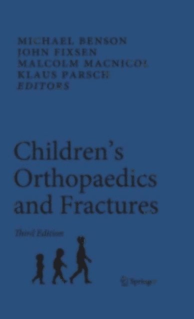Klausdieter Parsch, Malcolm Macnicol, John Fixsen, Michael Benson - Children's Orthopaedics and Fractures, E-bok. Tillgänglighet: Lägg i varukorg