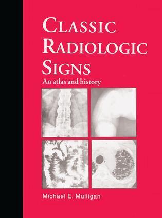 M.E. Mulligan - Classic Radiologic Signs, Inbunden. Tillgänglighet: Lägg i varukorg