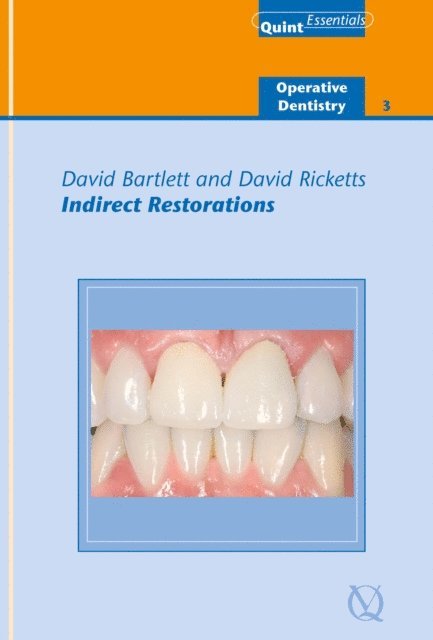 David Ricketts, David Bartlett - Indirect Restorations, E-bok