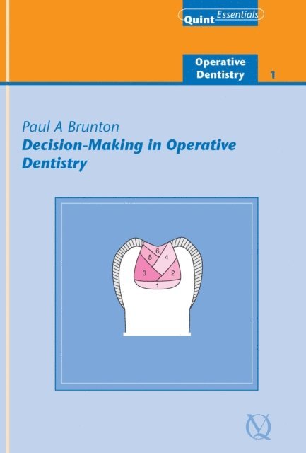 Paul A. Brunton - Decision-Making in Operative Dentistry, E-bok