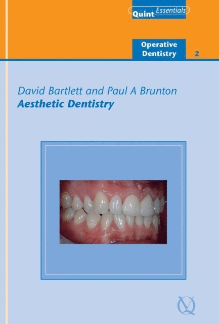 Paul A. Brunton, David Bartlett - Aesthetic Dentistry, E-bok