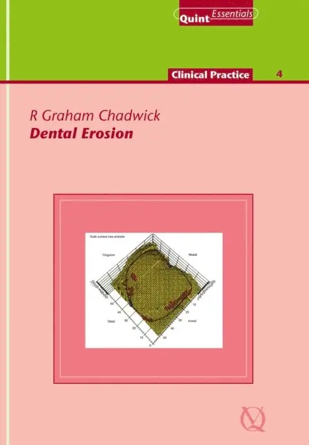 R. Graham Chadwick - Dental Erosion, E-bok. Tillgänglighet: Lägg i varukorg