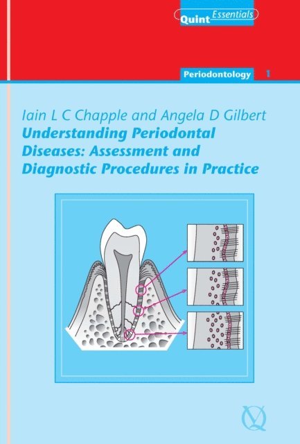 Angela Gilbert, Iain L. C. Chapple - Understanding Periodontal Diseases: Assessment and Diagnostic Procedures in Practice, E-bok