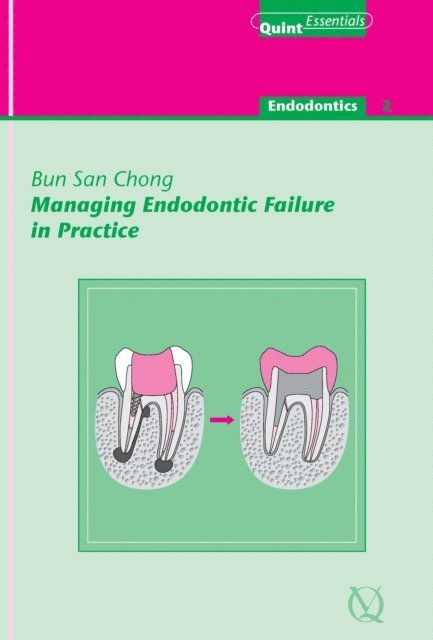 Bun San Chong - Managing Endodontic Failure in Practice, E-bok. Tillgänglighet: Lägg i varukorg