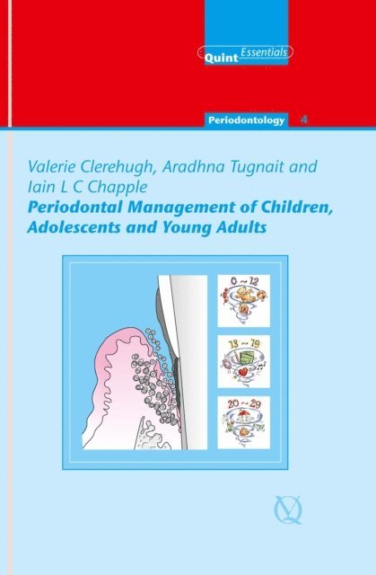 Iain L. C. Chapple, Aradhna Tugnait, Valerie Clerehugh - Periodontal Management of Children, Adolescents and Young Adults, E-bok