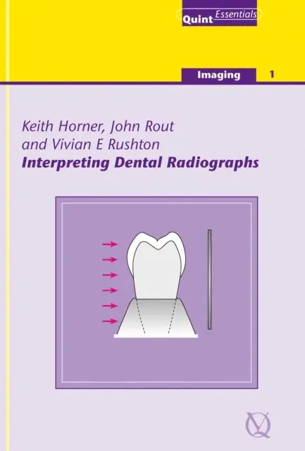 Vivian E. Rushton, John Rout, Keith Horner - Interpreting Dental Radiographs, E-bok. Tillgänglighet: Lägg i varukorg