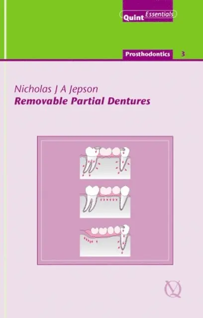 Nicholas J. A. Jepson - Removable Partial Dentures, E-bok. Tillgänglighet: Lägg i varukorg