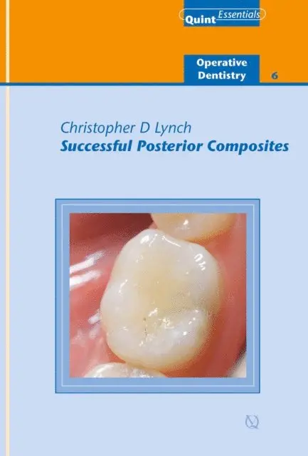 Christopher D. Lynch - Successful Posterior Composites, E-bok. Tillgänglighet: Lägg i varukorg