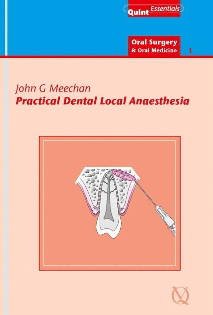 John G. Meechan - Practical Dental Local Anaesthesia, E-bok